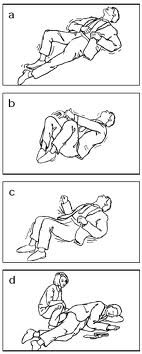 Signs And Symptoms That Can Be Seen During Grand Mal Seizures Check If Patient Is Showing Any New Sign Or Symptom During Grand Mal Seizures tonicclonic