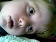 Petit mal seizure Treatment Approaching Towards Intelligent Use Of Anticonvulsant Drugs