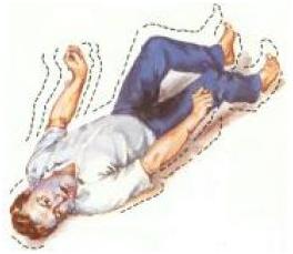 Handling People Experiencing Grand Mal Seizures